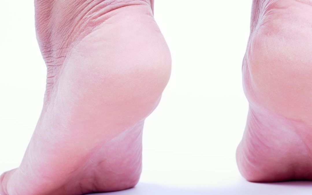 Rehab Exercises for ACL Injuries