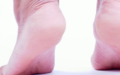 Rehab Exercises for ACL Injuries